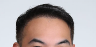 Transforming Anorectal Wellness: Carlos M. A. San Mateo, MD, Launches Alkimiya Surgical Systems in San Jose, California