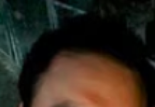 Martin D. Vera LVN, CWS: Transforming Lives Through Expert Wound Management in Texas