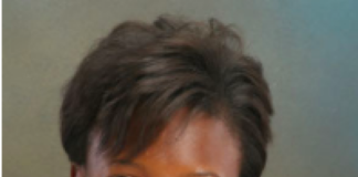 Tania C. Nkungula, DDS: A Pioneer in Oral and Maxillofacial Surgery