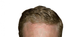 Gregory Messner, DO, FACOS, Joins Messner Vascular Institute as Leading Cardiovascular – Endovascular Surgeon in Dallas-Fort Worth