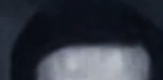 Dr. Michael H. Cunningham, MD, FAAO, Celebrates Over Five Decades of Vision Care Excellence in Spokane