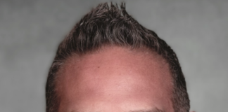 Brian Baldari on the Three Rules for Resilience Forged in the Refining Fire of Experience to Mentor the Next Generation