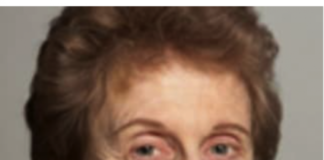 Judith J. Levine, MD: A Legacy of Excellence in Orthopedic Surgery and Leadership
