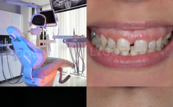 Why Istanbul Has Become the Preferred Destination for Smile Makeovers ?