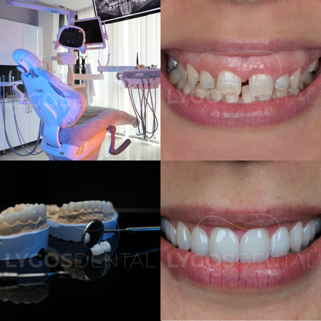rss_lygos-dental-before-and-after-and-clinical-photo1284242246