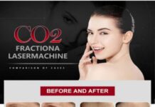 How to Effectively Use CO₂ Fractional Lasers for Scar Removal: A Comprehensive Buyer’s Guide