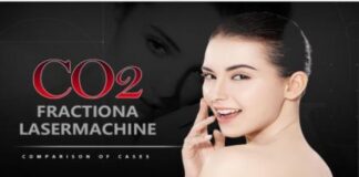 How to Effectively Use CO₂ Fractional Lasers for Scar Removal: A Comprehensive Buyer’s Guide