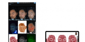 Decoding Machine Learning: Inside The Intelligence Of Future Leading Skin Analyzer Products From China